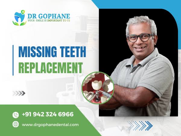Missing Teeth Replacement In Yavatmal product image