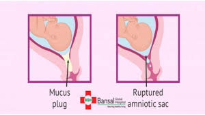 Minimal Fluid In Pod Recently My Ultrasound Result Came N Practo Consult