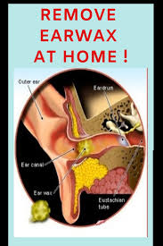 Remove Earwax At Home Plain Live Ear Wax Ear Drainage Cleaning Your Ears