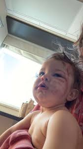 Fundraiser for Peyton Shafer by Marissa Breault : Urgent Help for Willow's  Surgery and Recovery