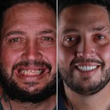 Dr. Marcus Batista (@drmarcus_batista) • Instagram photos and videos