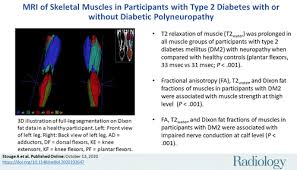 Mri Of Skeletal Muscles In Participants With Type 2 Diabetes With Or Without Diabetic Polyneuropathy Radiology