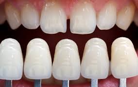 Esthetic Cosmetic Dentistry Esthetic Cosmetic