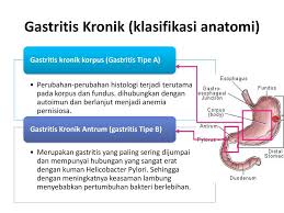 Jenis gastritis yang lainnya yaitu gastritis kronik. Penyakit Gastrointestinal Dalam Kehamilan Ppt Download