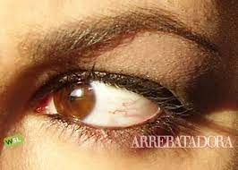 Si Tienes Venitas En Los Ojos Evita Los Colirios Cosmeticos