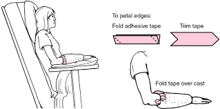 Petaling Definition Of Petaling By Medical Dictionary Medical Dictionary Medical Terms Medical