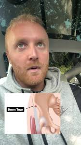 Hip Injury Update: MRI Results