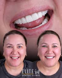 Elit Dental Clinic Kusadasi