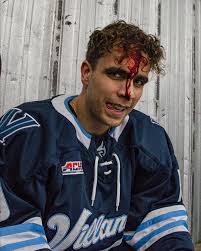 Before ➡️ After #HockeyGuy Shoutout to @joeye28 who took a puck to the face 