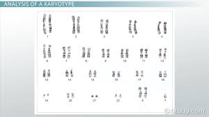 Karyotype Definition Disorders Analysis