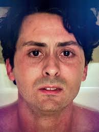 In IT chapter 2 (2019) Stan's scars around his face are clearly visible in  the tub scene, those scars caused by his encounter with it in the first  movie. Reflecting the trauma