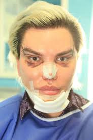 Ultimate cat eye beauty hack | lexi wood подробнее. The Human Ken Doll Undergoes Controversial Surgery To Look Like A Sexy Cat Mirror Online