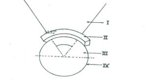 The discus is thrown from a circle measuring 2.5 meters, or 8.2 feet, in diameter. Physical Education Paper 3 Wassce Pc 2017
