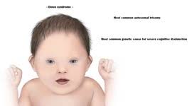 YouTuber with Tourette's syndrome documents the challenge of walking  through airport security