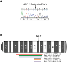 Check spelling or type a new query. Combined Genetic And Genealogic Studies Uncover A Large Bap1 Cancer Syndrome Kindred Tracing Back Nine Generations To A Common Ancestor From The 1700s