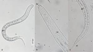 Image result for Strongyloides