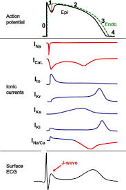 The humps of camels, leaning to one side. Clinical And Mechanistic Issues In Early Repolarization Of Normal Variants And Lethal Arrhythmia Syndromes Sciencedirect