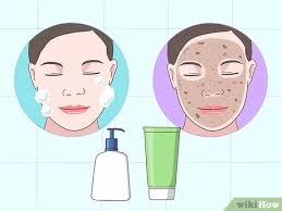 Browse and download minecraft white skins by the planet minecraft community. 3 Ways To Get Rosy White Skin Wikihow