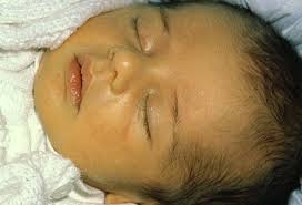 Urquhart says that skin cancer is rare before kids go through puberty. Baby Skin Care Tips To Keep Newborn S Skin Healthy