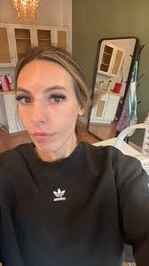 Plump youthful skin? Obviously I’m in. Not only am I microneedling my skin,  which is stimulating elastin and collagen, but I am microneedling with  hyaluronic acid. I’m penetrating that into my skin ...