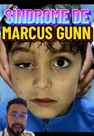 Marcus Ginn