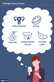 Signs And Symptoms Of An Enlarged Uterus In 2020 Uterus Enlarged Ovarian