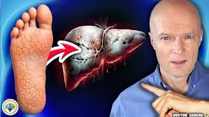 Bihari fish curry recipe || Indian fish Masala curry recipe || fish curry  ||