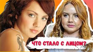 We did not find results for: Chto Sluchilos S Licom Pevicy Maksim Youtube