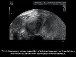 International Society Of Ultrasound In Obstetrics And Gynecology Isuog New Uogjournal Videoclip Facebook
