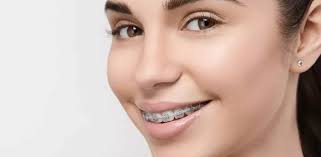 Invisalign Dentist Specialist Coral Gables, Florida