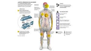 Saiba mais sobre a síndrome de guillain barré. Guillain Barre Un Sindrome Y Una Incognita Tecnologia El Comercio Peru