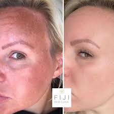 Fiji Skin Clinic added a new photo — at...