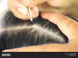 Then, use one hand to hold the skin taut, and the. People Using Tweezers Image Photo Free Trial Bigstock