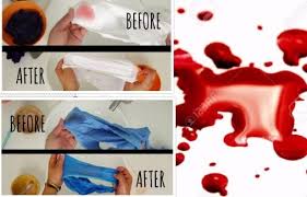 Hilangkan warna merah pad seluar putih. Singkirkan Kesan Darah Pada Pakaian Anda Kisah Dunia