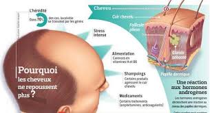 Visage, tronc, cuisses, cuir chevelu ou autres. Alopecie Quelles Causes Fiches Sante Et Conseils Medicaux