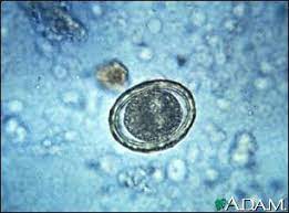 Ascariasis Healthing Ca