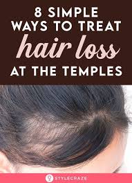 This simply refers to a hereditary predisposition to hair loss. 8 Simple Ways To Treat Hair Loss At The Temples Hair Loss Remedies Women What Causes Hair Loss Hair Thickening Remedies