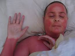 An initial encounter creates the opportunity for sensitization. Allergic Reaction On Face Treatment Causes And Symptoms