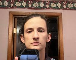 what causes excess hunger?