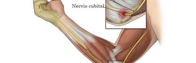 Estiramiento Para Musicos Con Pinzamiento Del Nervio Cubital Gran Pausa