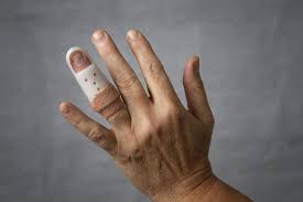 Thanks for info when finger is dislocated it should be reduced as soon as possible because in the state of how justanswer works. Dislocated Finger What To Do Plus Symptoms Causes And Treatment