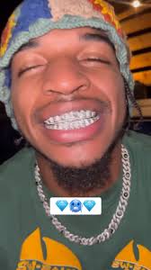 Chase West Grillz
