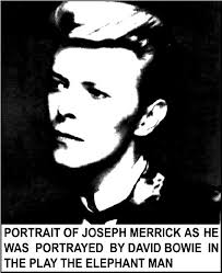 portrait of Joseph Merrick as he was portrayed by David Bo…