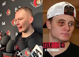 [BR Open Ice] Thomas Chabot took a puck to the face and headed quickly off  the ice for repairs : r/hockey