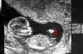Gender reveal ideas and tips on planning a fun gender reveal party. The Simple Trick To Tell The Sex Of Your Baby At Just 12 Weeks But Does It Really Work