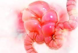Colon Cancer Vs Ibs Differences Between Symptoms Signs