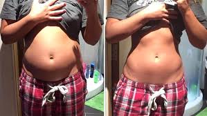 12 goldene tipps zum verbrennen von bauchfett und 5 dumme fehler, die es zu vermeiden gilt, für einen flachen und strammen bauch! Blahbauch Ursache Erkennen Und Loswerden