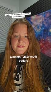 Austin Rigdon's Instagram, Twitter & Facebook