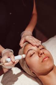 Microdermabrasion Denver
