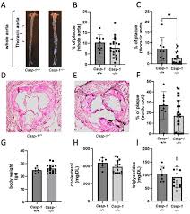 Deficiency of Caspase-1 Attenuates HIV-1-Associated Atherogenesis in Mice